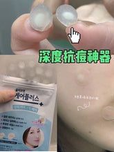 Load image into Gallery viewer, 韓國Olive Young痘痘貼(範冰冰推薦)~祛痘貼超薄隱形淨痘貼102貼