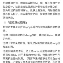 Load image into Gallery viewer, 韓國Olive Young痘痘貼（範冰冰推薦）～祛痘貼超薄隱形淨痘貼102貼
