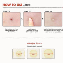 Load image into Gallery viewer, COSRX 去吧痘痘貼 韓國熱銷 痘痘貼Acne Pimple Master Patch 24枚
