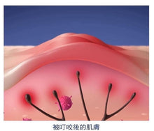 Load image into Gallery viewer, 日本🇯🇵MUHI無比止癢消炎液50ml
